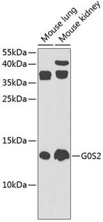G0S2 Polyclonal Antibody