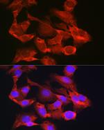 G6PC3 Antibody in Immunocytochemistry (ICC/IF)