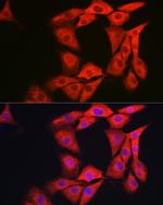 GAMT Antibody in Immunocytochemistry (ICC/IF)