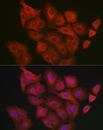 GART Antibody in Immunocytochemistry (ICC/IF)