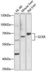 GCKR Polyclonal Antibody