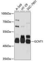 GCNT1 Polyclonal Antibody