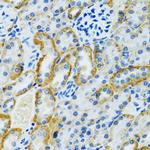 GDAP1 Antibody in Immunohistochemistry (Paraffin) (IHC (P))