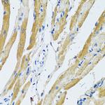 GDAP1 Antibody in Immunohistochemistry (Paraffin) (IHC (P))