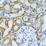GDAP1 Polyclonal Antibody