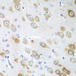 GFM1 Antibody in Immunohistochemistry (Paraffin) (IHC (P))