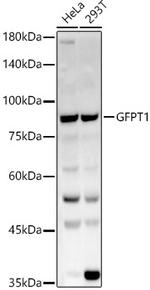 GFPT1 Polyclonal Antibody