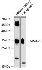 GIMAP5 Polyclonal Antibody