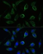 GK2 Polyclonal Antibody