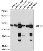 GLB1L3 Polyclonal Antibody