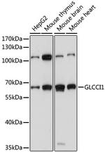 GLCCI1 Antibody in Western Blot (WB)
