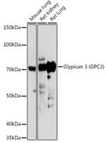 Glypican 3 Polyclonal Antibody