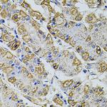 PRAMEF20 Polyclonal Antibody