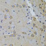 PRAMEF20 Antibody in Immunohistochemistry (Paraffin) (IHC (P))