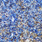 GMIP Antibody in Immunohistochemistry (Paraffin) (IHC (P))