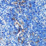 GMIP Antibody in Immunohistochemistry (Paraffin) (IHC (P))