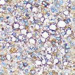 GMIP Polyclonal Antibody