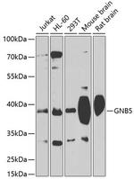 GNB5 Polyclonal Antibody