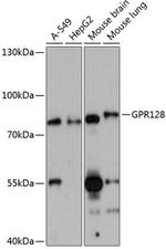 GPR128 Polyclonal Antibody