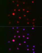 GPS1 Polyclonal Antibody