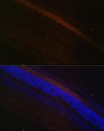 GRK1 Antibody in Immunohistochemistry (Paraffin) (IHC (P))