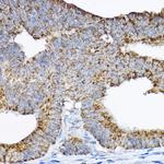 GRPEL2 Polyclonal Antibody