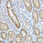 GRPEL2 Antibody in Immunohistochemistry (Paraffin) (IHC (P))