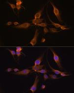 GSTA1 Antibody in Immunocytochemistry (ICC/IF)
