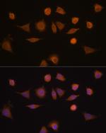 GSTA1 Antibody in Immunocytochemistry (ICC/IF)