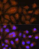 GSTT2B Antibody in Immunocytochemistry (ICC/IF)