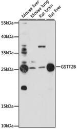 GSTT2B Antibody in Western Blot (WB)