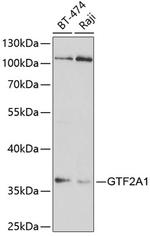 GTF2A1 Polyclonal Antibody