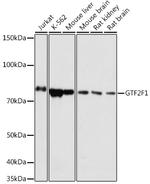 GTF2F1 Polyclonal Antibody