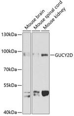 GUCY2D Polyclonal Antibody
