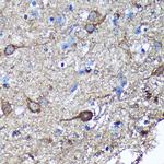 GULP1 Antibody in Immunohistochemistry (Paraffin) (IHC (P))