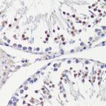 HFM1 Antibody in Immunohistochemistry (Paraffin) (IHC (P))