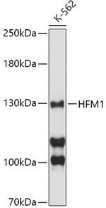 HFM1 Antibody in Western Blot (WB)