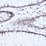 Histone H1.0 Antibody in Immunohistochemistry (Paraffin) (IHC (P))
