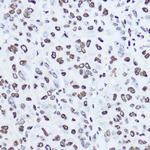 Histone H1.0 Polyclonal Antibody