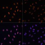 H2BK12ac Polyclonal Antibody