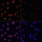 H3K36ac Polyclonal Antibody