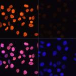 H3K4ac Antibody in Immunocytochemistry (ICC/IF)