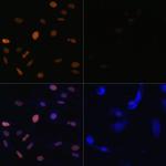 H3K23ac Polyclonal Antibody