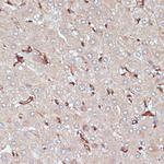 HLA-DRA Antibody in Immunohistochemistry (Paraffin) (IHC (P))