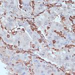 HLA-DRA Antibody in Immunohistochemistry (Paraffin) (IHC (P))