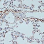 HLA-DRA Antibody in Immunohistochemistry (Paraffin) (IHC (P))