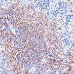 HLA-DRA Antibody in Immunohistochemistry (Paraffin) (IHC (P))