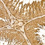 HN1 Antibody in Immunohistochemistry (Paraffin) (IHC (P))