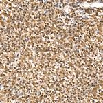 HN1 Polyclonal Antibody