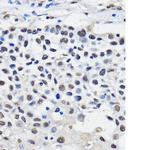HNRNPU Antibody in Immunohistochemistry (Paraffin) (IHC (P))